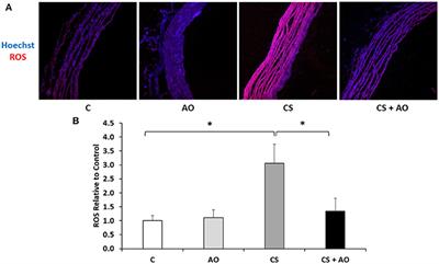 Cigarette Smoking-Induced Cardiac Hypertrophy, Vascular Inflammation and Injury Are Attenuated by Antioxidant Supplementation in an Animal Model